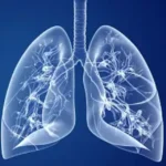 વધતા પ્રદૂષણની ફેફસાં પર થઈ શકે છે નકારાત્મક અસર, સ્વસ્થ રાખવા માટે આ વસ્તુઓનું સેવન કરો