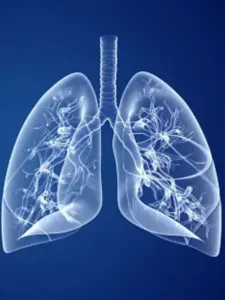 વધતા પ્રદૂષણની ફેફસાં પર થઈ શકે છે નકારાત્મક અસર, સ્વસ્થ રાખવા માટે આ વસ્તુઓનું સેવન કરો